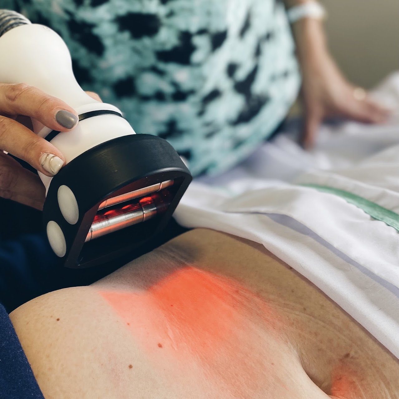 Tratamiento corporal con radiofrecuencia